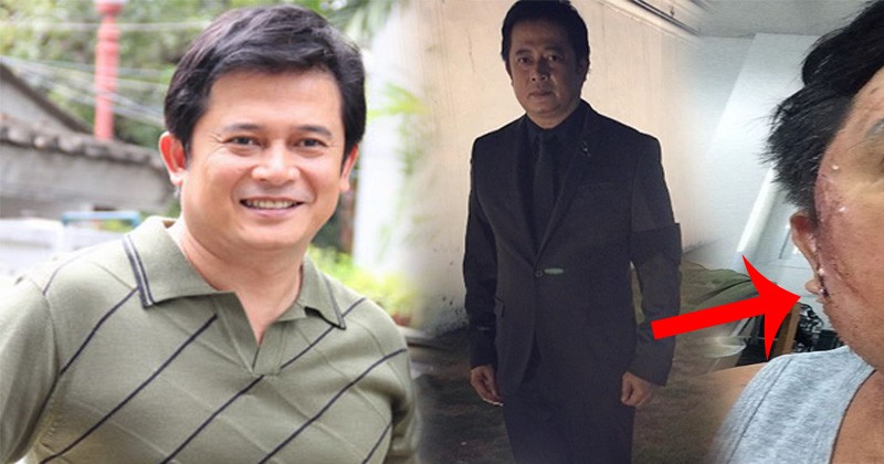 ผมเป็นโรคร้ายครับ !! นักเเสดงรุ่นใหญ่ “สันติสุข พรหมศิริ” ประกาศกลางไอจี แต่พอรู้ความจริงเท่านั้นแหละ โคตรเทพ !!