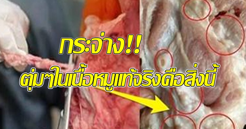ไขกระจ่าง!! ตุ่มๆเป็นก้อน ในเนื้อหมู สีออกเทาปนเหลือง แท้จริงแล้วไม่ใช่ต่อมพิษแต่คือสิ่งนี้ แพทย์เตือนอันตรายจริง ห้ามกินเด็ดขาด!!(คลิป)
