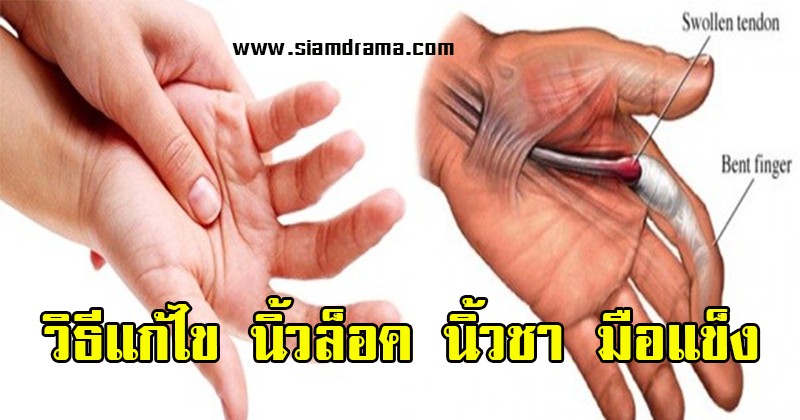 ลองแล้วดีจริง!! นิ้วล็อค นิ้วชา มือแข็ง มีวิธีแก้ไข ลองทำตามนี้เลย ไม่ต้องทนทรมานกันอีกต่อไปแล้ว (ชมคลิป)