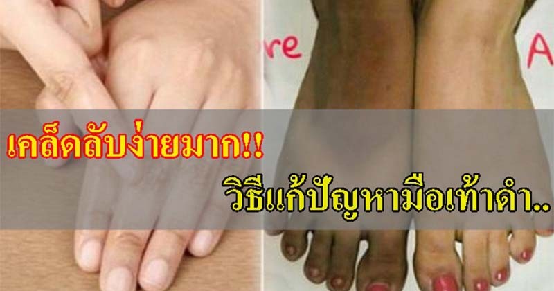 แชร์เก็บไว้เลย !! เผยเคล็ดลับดีๆ " วิธีแก้ปัญหามือเท้าดำ" ทำง่าย และได้ผลลัพธ์โคตรเจ๋ง ด้วยของใช้ในครัวเหล่านี้ ? (รายละเอียด)
