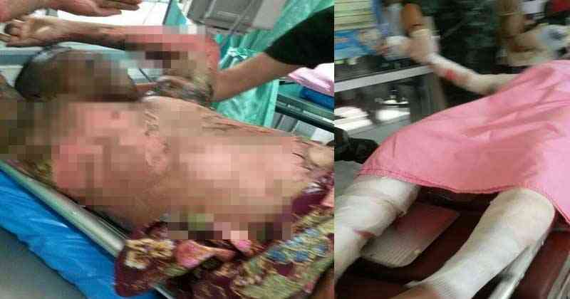 สุดเวทนา!! ทหารรั่วของชาติถูกเผาทั้งเป็น!! วิงวอนขอรับ บริจาคเลือดกรุ๊ป “บี” หรือ “โอ” เพื่อต่อล้มหายใจทหารชายแดนใต้!? (1 แชร์ 1 ความช่วยเหลือ)