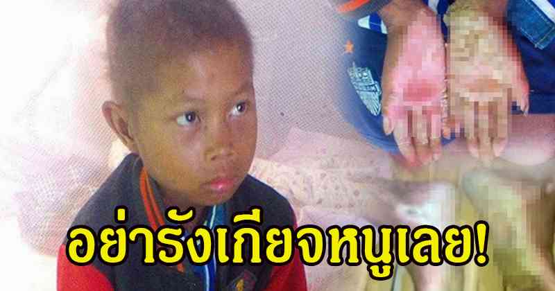 ช่วยผมด้วยผมเจ็บ!! สุดเวทนา เด็กชายกำพร้าพ่อแม่ "อยู่บ้านคนเดียวกับหมาแมว" ซ้ำปวยเป็นโรคที่คนรังเกียจ พูดทั้งน้ำตาอย่ารังเกียจหนูเลย!? (มีคลิป)