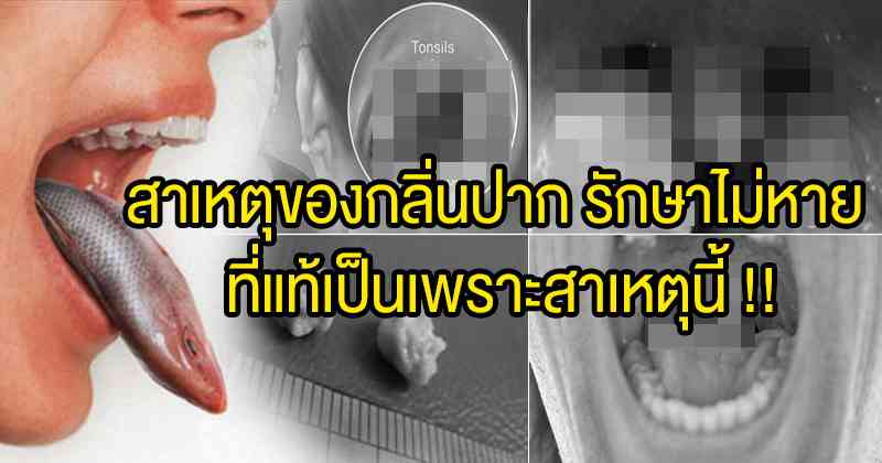 กระจ่าง !! สาเหตุของกลิ่นปาก รักษาไม่หาย ที่แท้เป็นเพราะสาเหตุนี้ อย่ารอช้ารีบเช็คด่วน !?!