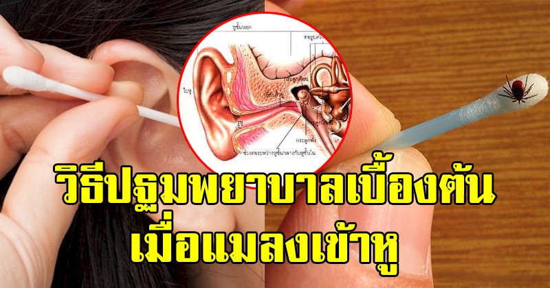 หลายคนทำผิดวิธี เผยการปฐมพยาบาลเบื้องต้น เมื่อแมลงเข้าหู นำไปใช้ยามฉุกเฉิน